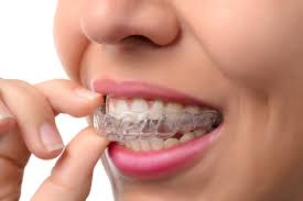 Dental Tricks Every Invisalign Patients Should Know