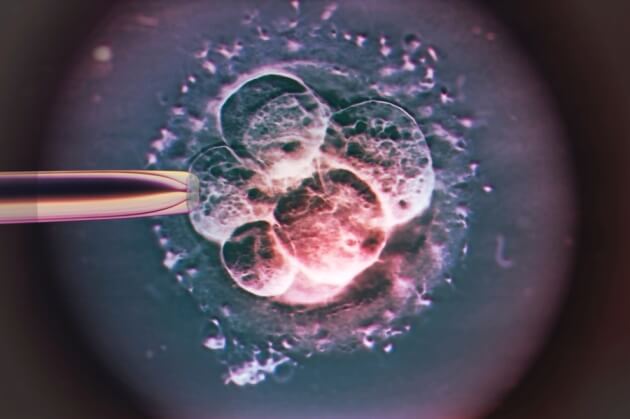 A quick guide to IVF